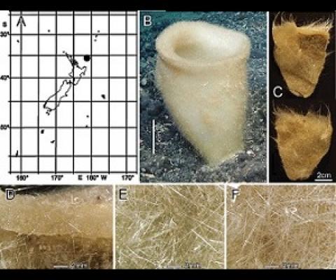 Bathydorus poculum sp. nov., holotype NIWA 126338, distribution, skeleton, and morphology A distribution in New Zealand waters B holotype in situ (scale bar approximate) C dermal (upper) and atrial (lower) sides of the preserved main part of the collected fragment D magnified area of the oscular margin, showing the atrial surface curving out over the dermal surface E dermal surface with dense prostal diactins F atrial surface with similarly dense prostal diactins. Image B captured by ROV Team GEOMAR, ROV Ki