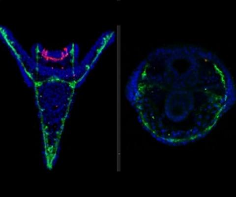 The skeleton (green) and nervous system (magenta) of sea urchin larvae are affected by chemicals from microplastics. Left - not treated. Right - treated. Credit: Periklis Paganos