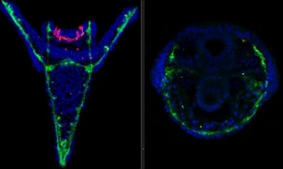 The skeleton (green) and nervous system (magenta) of sea urchin larvae are affected by chemicals from microplastics. Left - not treated. Right - treated. Credit: Periklis Paganos