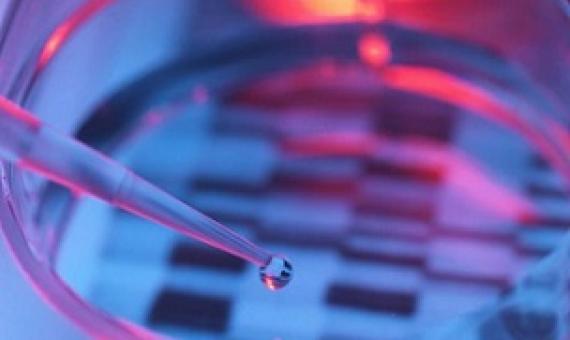 Even tiny water samples, like this droplet, often contain DNA of the fish and other species that live in an area. Using new eDNA sampling and analysis, scientists can help improve management of marine protected areas. Credit - Andrew Brookes Getty Images