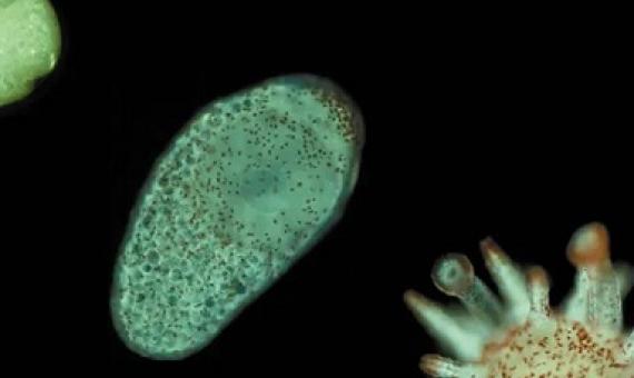 This photo shows a developing sea urchin, from egg (top left) to larva, to a metamorphosed (matured into adult form) individual. Dustin Marshall, Author provided